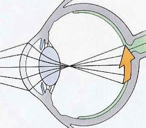 eye near